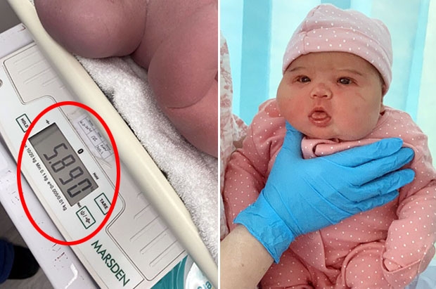  영국에서 6KG 초우량아 탄생