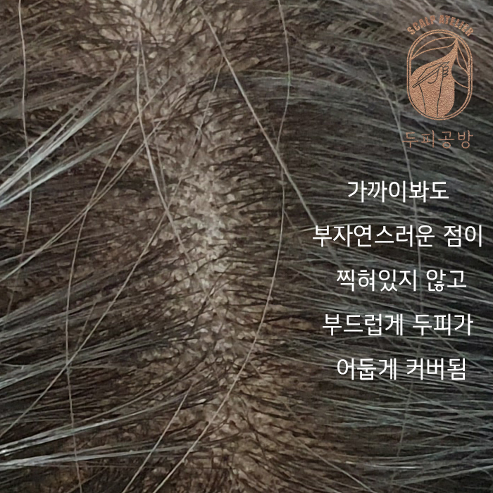 정수리두피문신 after