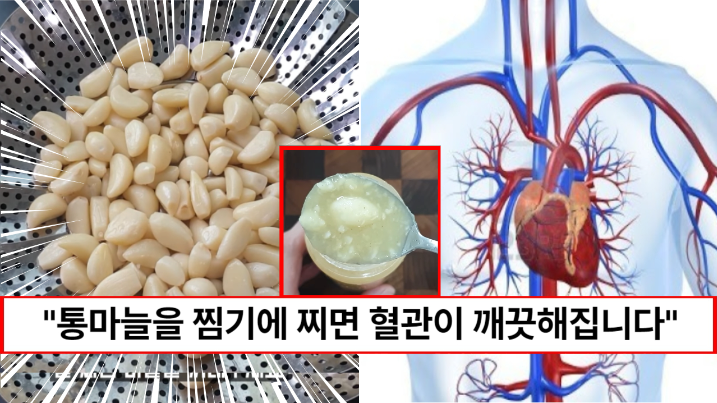 “깐마늘은 그래로 찜기에 넣어보세요” 막힌 혈관이 뻥 뚫어지는 혈관보약 꿀마늘 만드는 방법