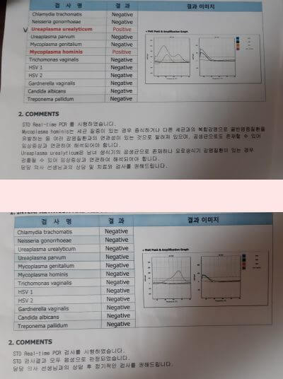  유레아플라즈마(유레아리티쿰,파붐) 증상, 치료기간, 완치  살펴보기