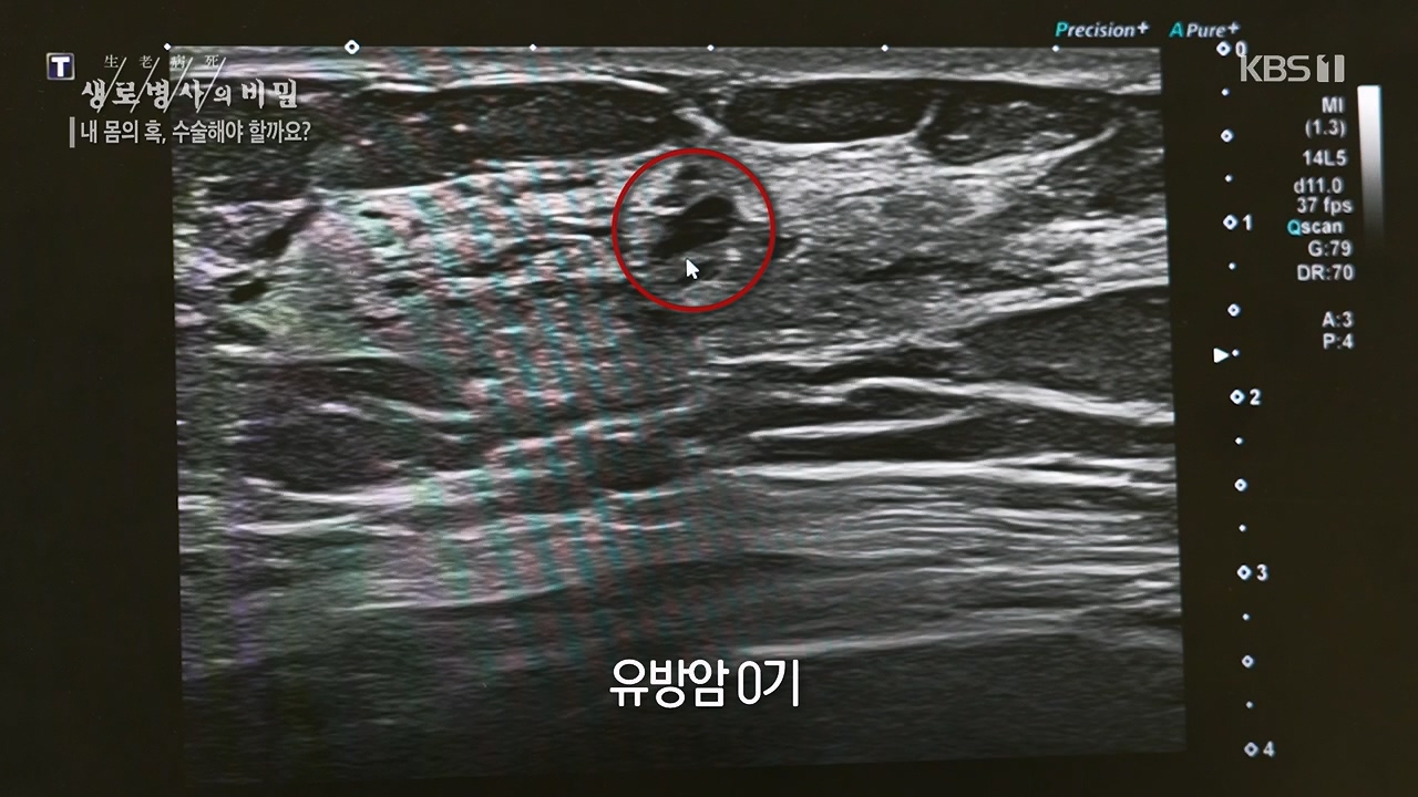 생로병사의 비밀.E870.230532p.H264-F1RST.mp4_20230605_201517.555.jpg