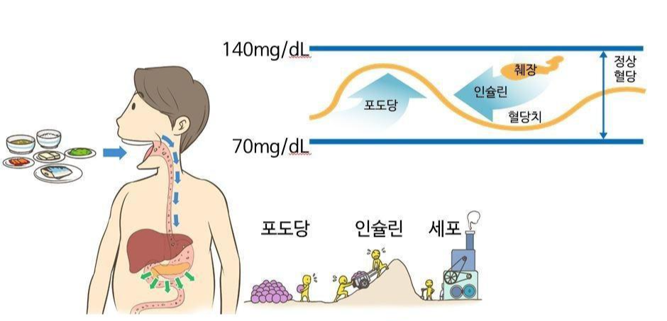 인슐린 저항성