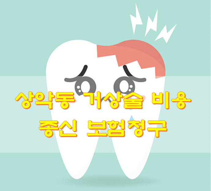  상악동 거상술 비용 종신 보험청구
