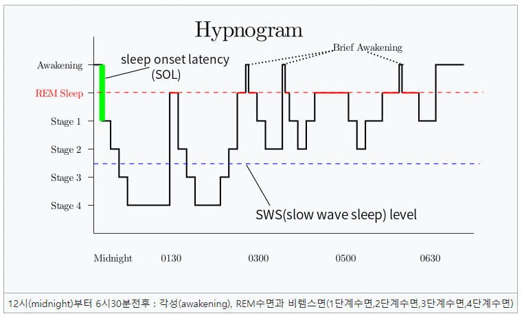 수면 그래프