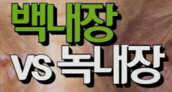  시 신경 손상 녹내장 원인, 증상, 검사 병원, 치료법