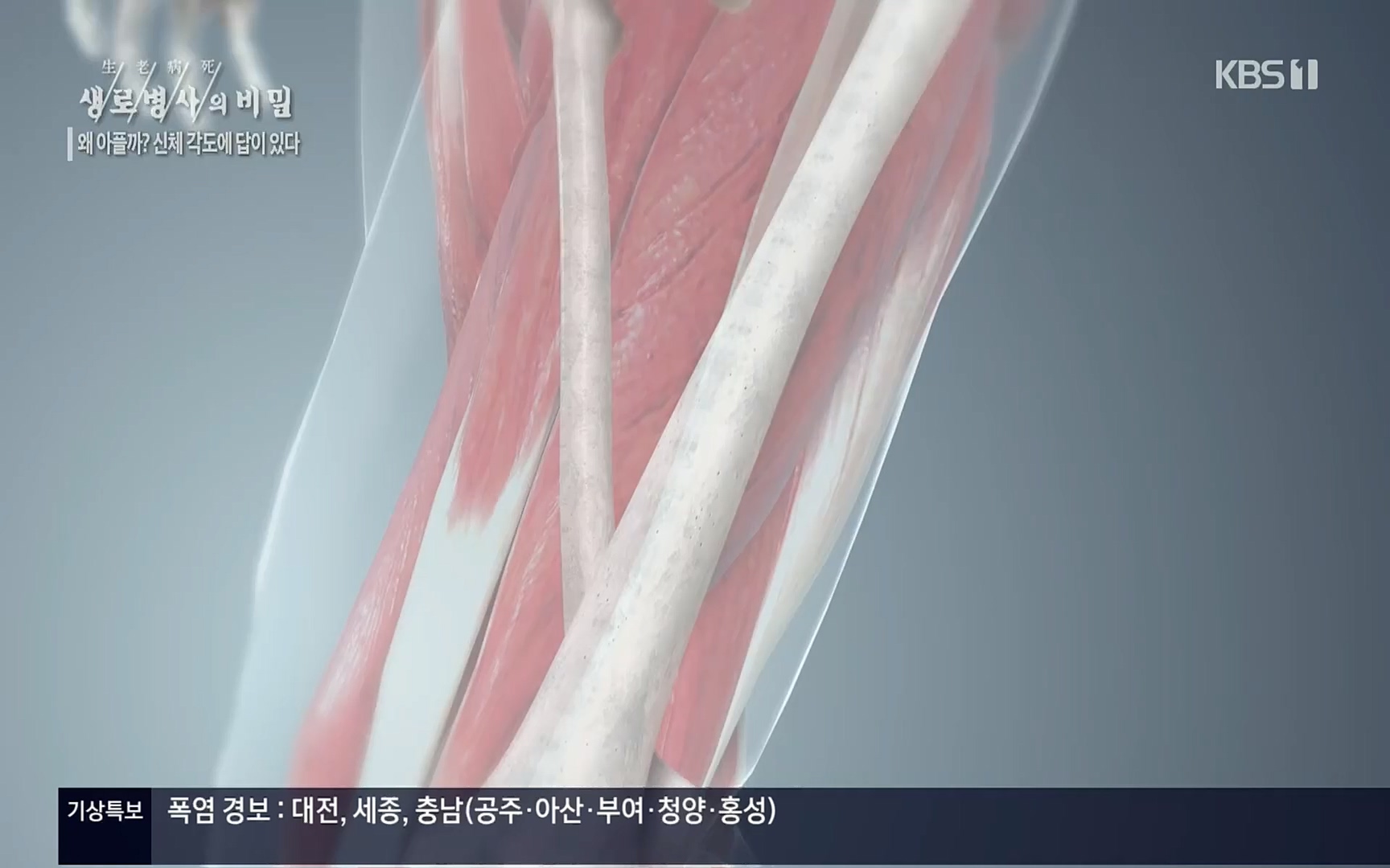 생로병사의 비밀.E825.220706p.H264-F1RST.mp4_20220707_185755.010.jpg