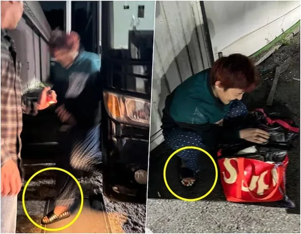 지압슬리퍼 부작용 지드래곤 지디 슬리퍼 효과_8