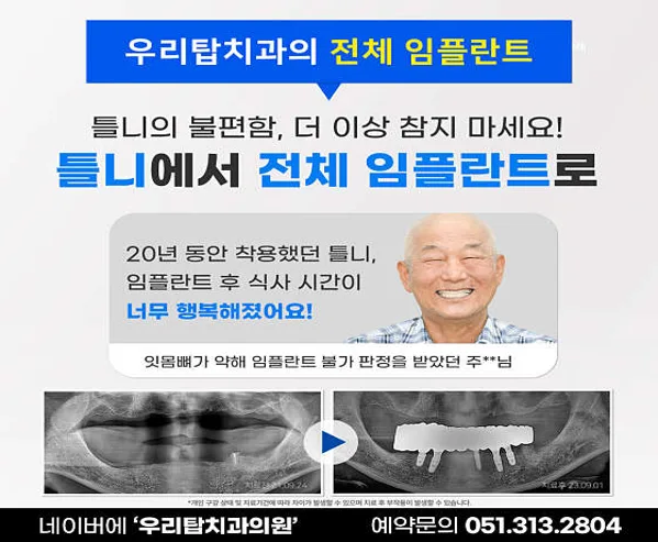 우리탑치과의원