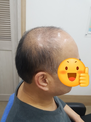센스모 이미지