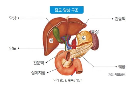  술과 담도염 담낭염 담석 담도암 담낭암 관계 및 원인과 증상 치료방법