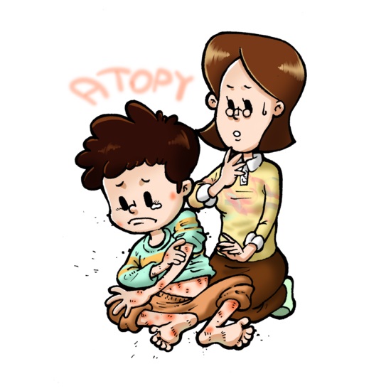  "아토피성 피부염의 이해 : 원인, 증상 및 치료"