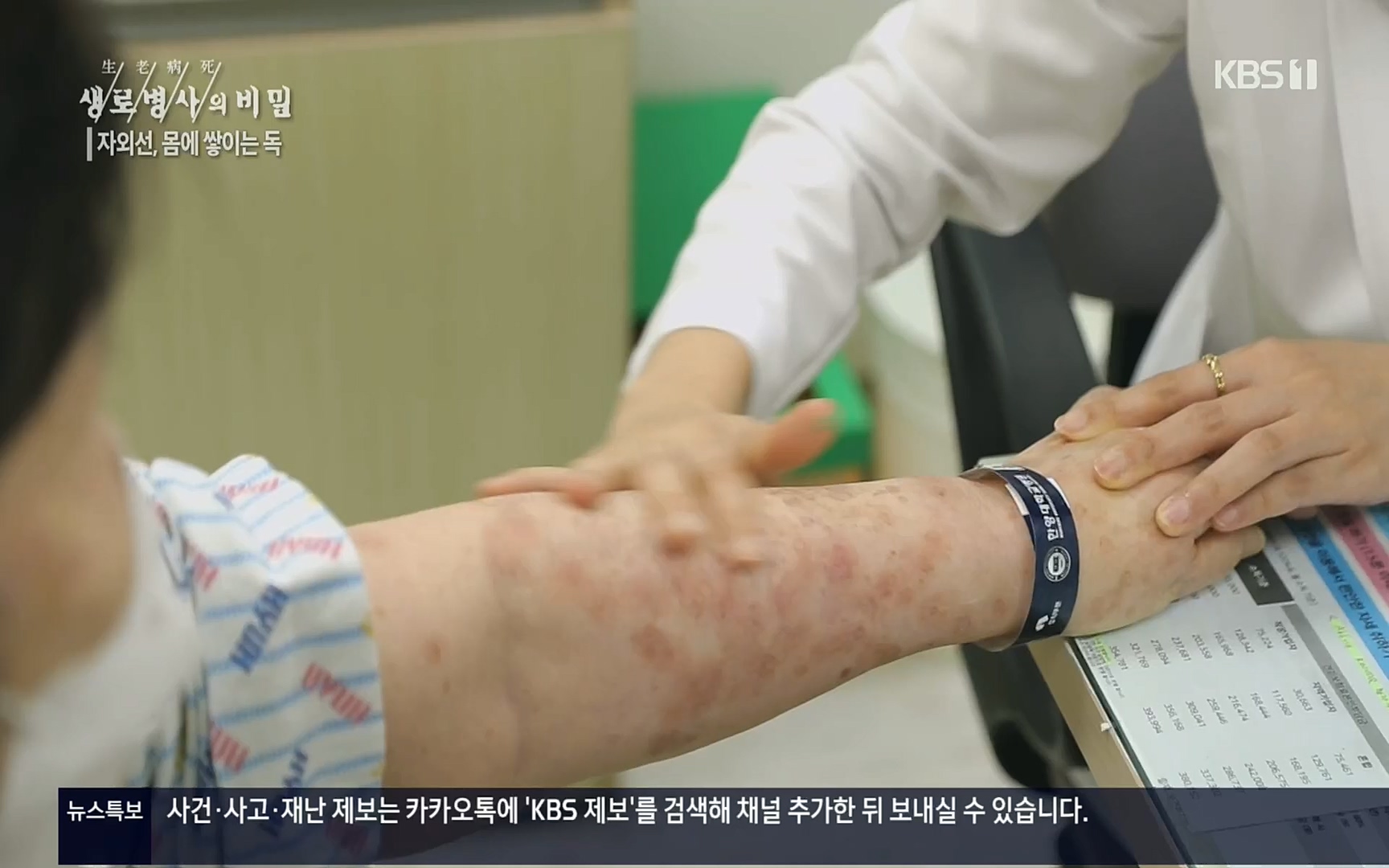 생로병사의 비밀.E824.220629p.H264-F1RST.mp4_20220630_205906.822.jpg