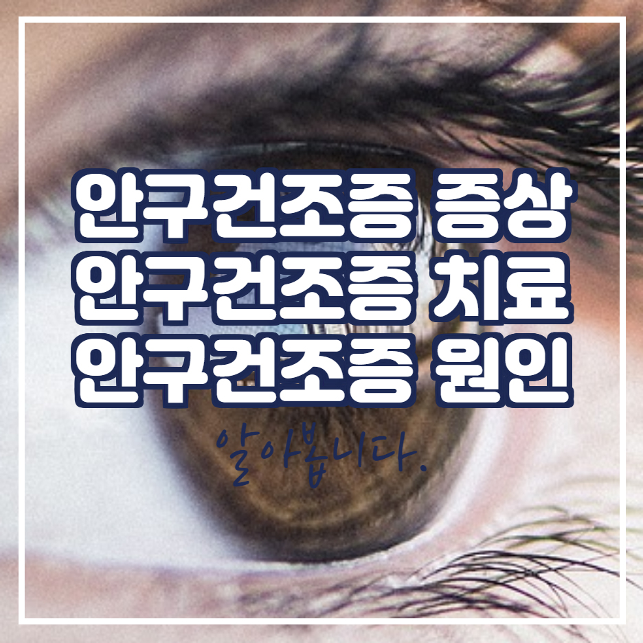  안구 건조증 증상 및 치료 방법