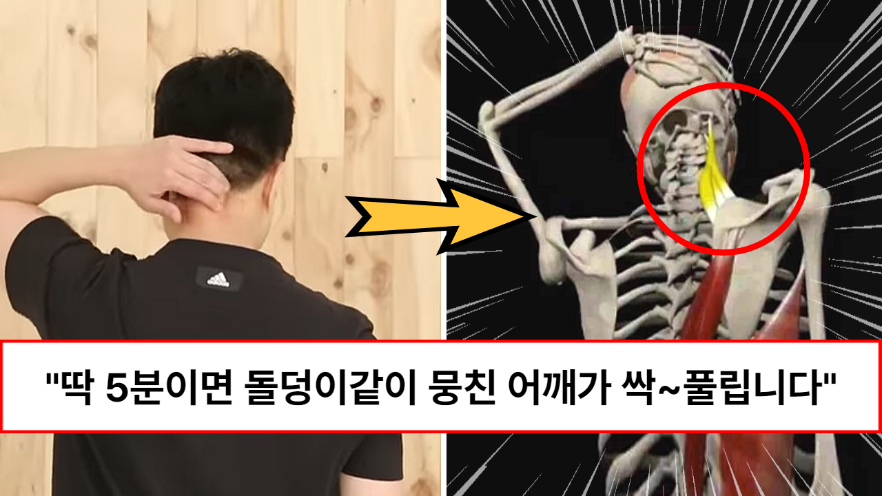 “속는셈치고 따라해 보세요” 물리치료사가 알려주는 거짓말처럼 편해지는 역대급 목어깨통증 운동 방법