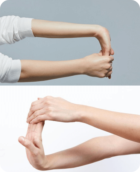 손목터널증후군 스트레칭하는 방법