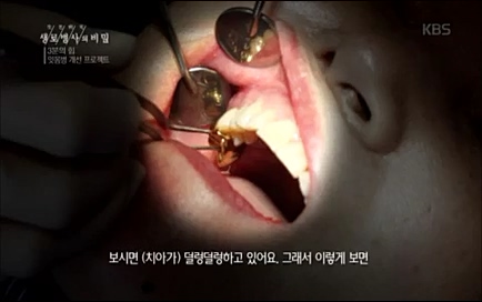 [670회] 생로병사의 비밀 - KBS670회] 생로병사의 비밀.ts_20220505_143202.715.jpg