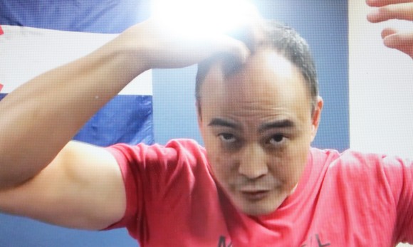 머리가 아니라 두피가 아파요. 신경학적 검사를 통해 통증의 원인을 찾을 수 없습니다