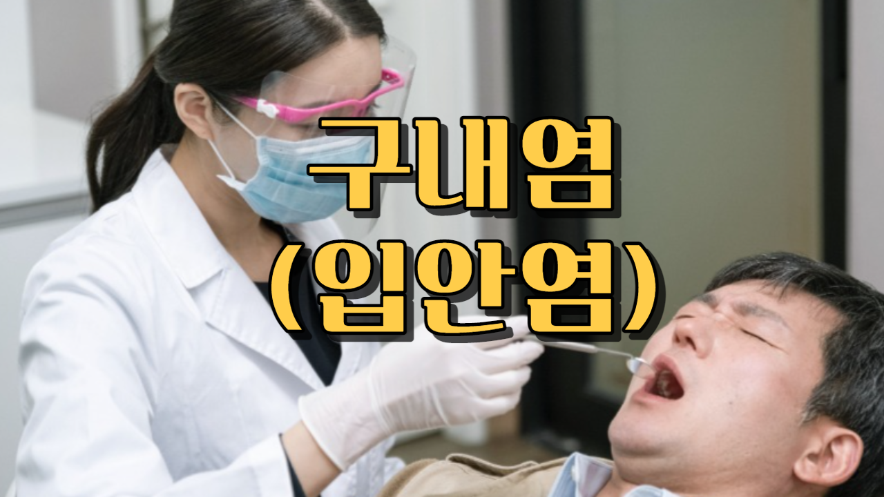  구내염 (입안염)