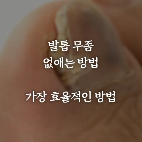 발톱-무좀-없애는-방법