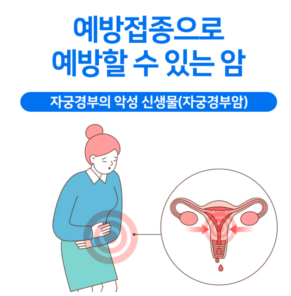 자궁경부암 검사방법 자궁경부암 검사비용