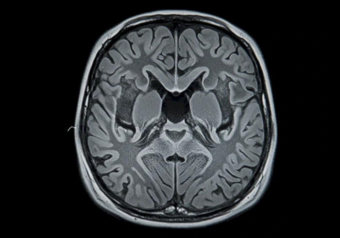 선명하게 표현된 뇌의 단면 MRI 이미지.