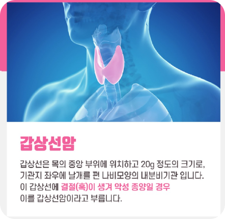 갑상선암수술비용3