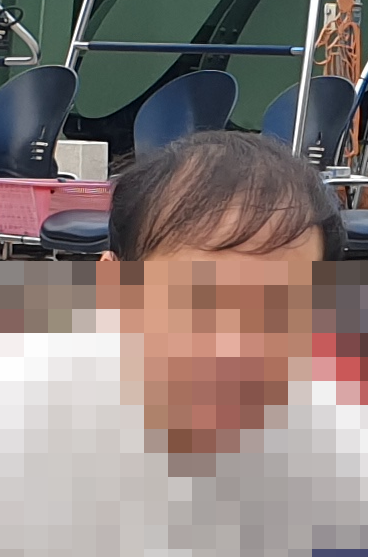탈모약 먹기 시작할 즈음 여행사진 1