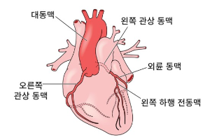 관상-동맥-질환