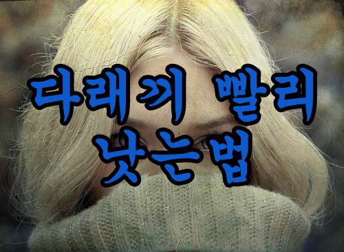  눈 다래끼 빨리 낫는 법 그리고 원인과 치료방법