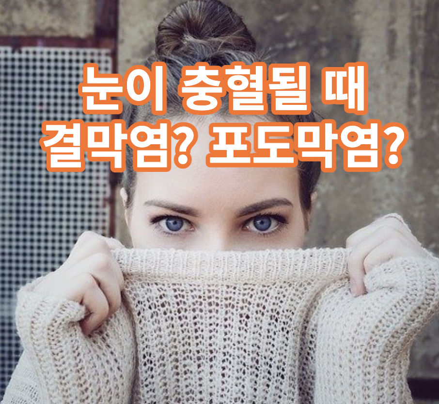 눈이 충혈될 때