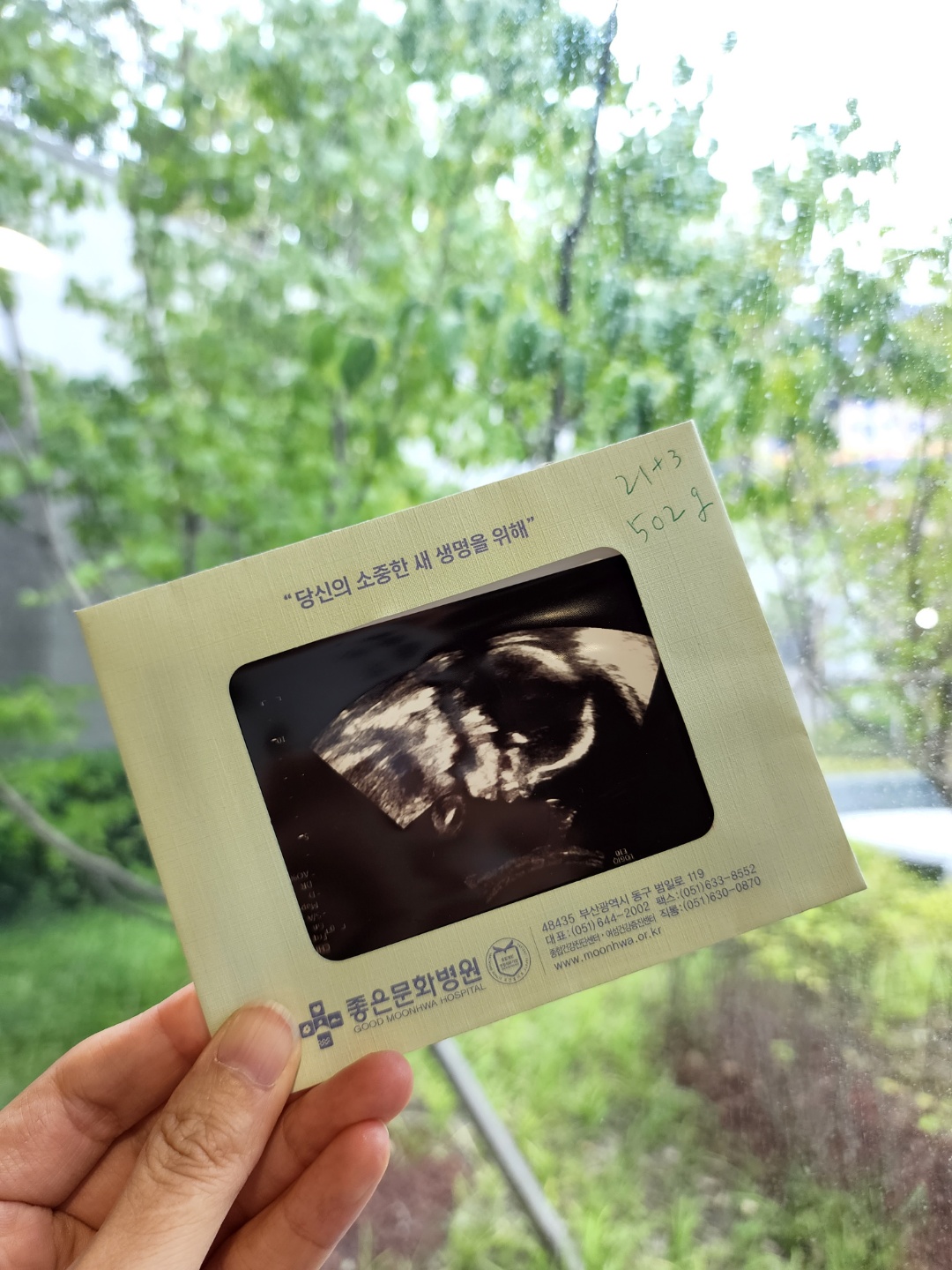  임신 6개월 차 정밀 초음파 검사 범위, 시기, 다른 초음파 차이까지 알아봐요