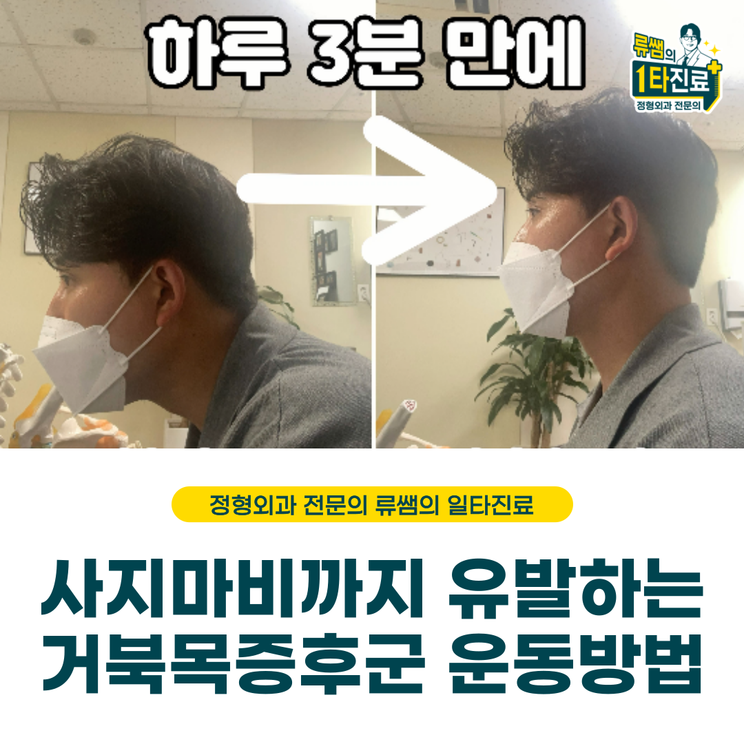  방치하면 사지마비까지 발생하는 거북목 증후군 교정법