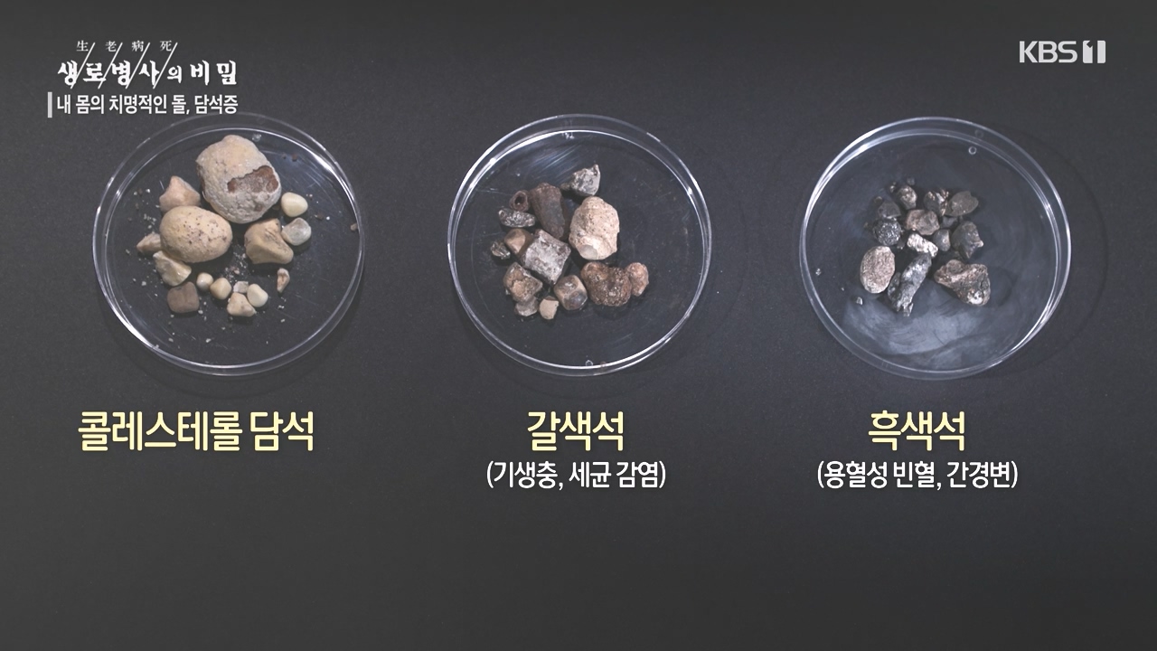 생로병사의 비밀.E886.231019p-NEXT.mp4_20231019_203444.807.jpg