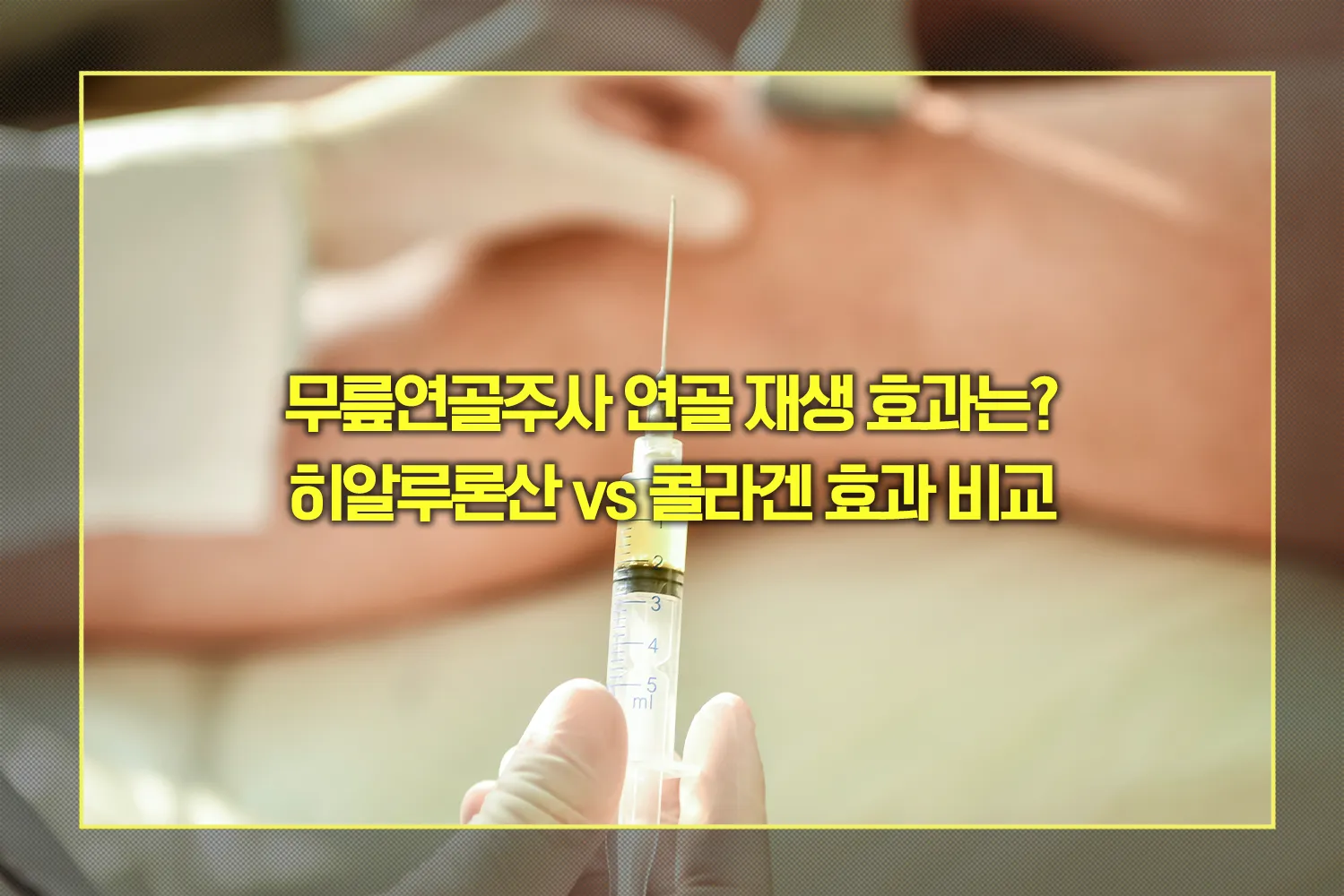 무릎연골주사 연골 재생 효과