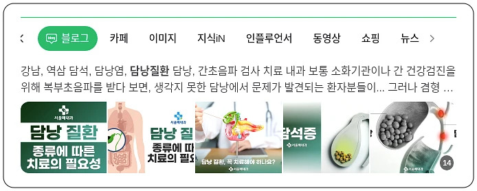 담낭 질환_1_subsection