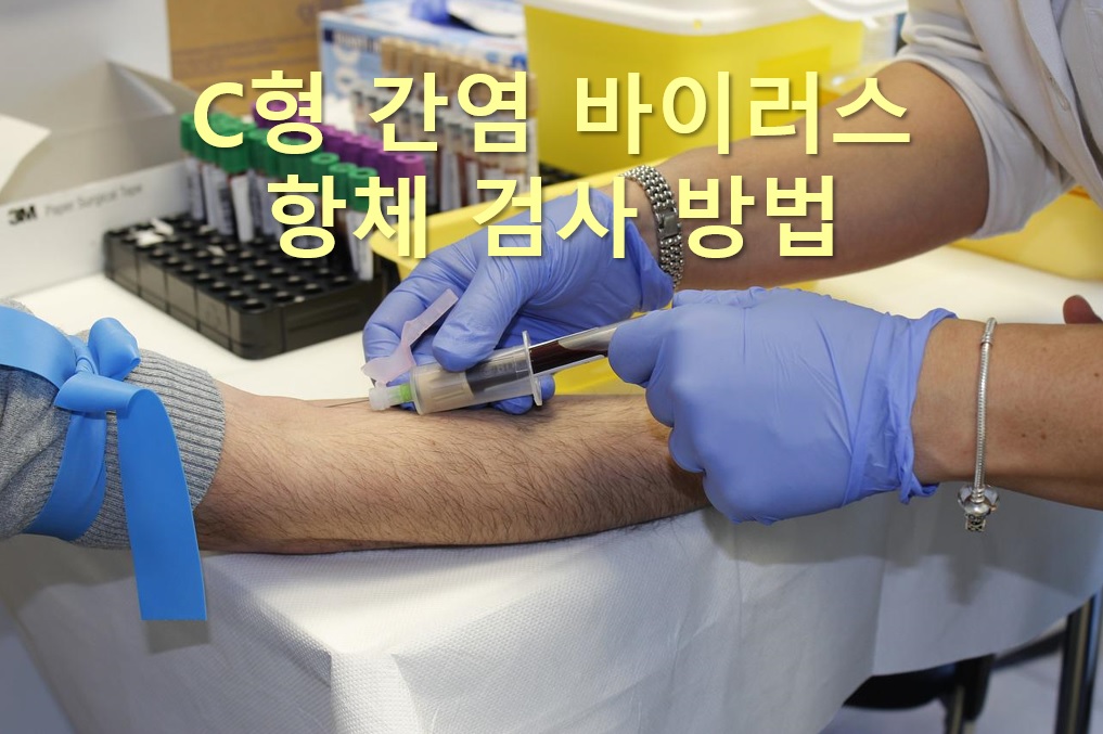  C형 간염 바이러스 항체 검사 방법