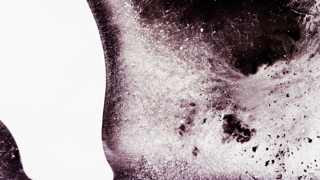 Atopic dermatitis