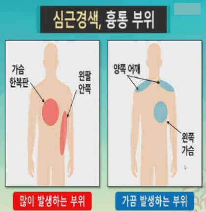  소화 불량의 증상별 위험에 췌장암이나 심근경색과 관련