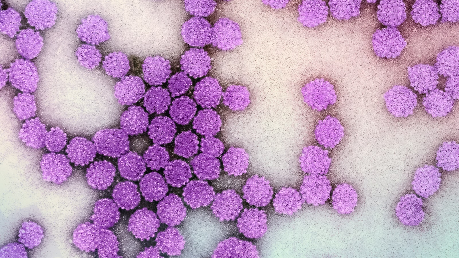  HPV 바이러스의 잠복기: 이해와 대처