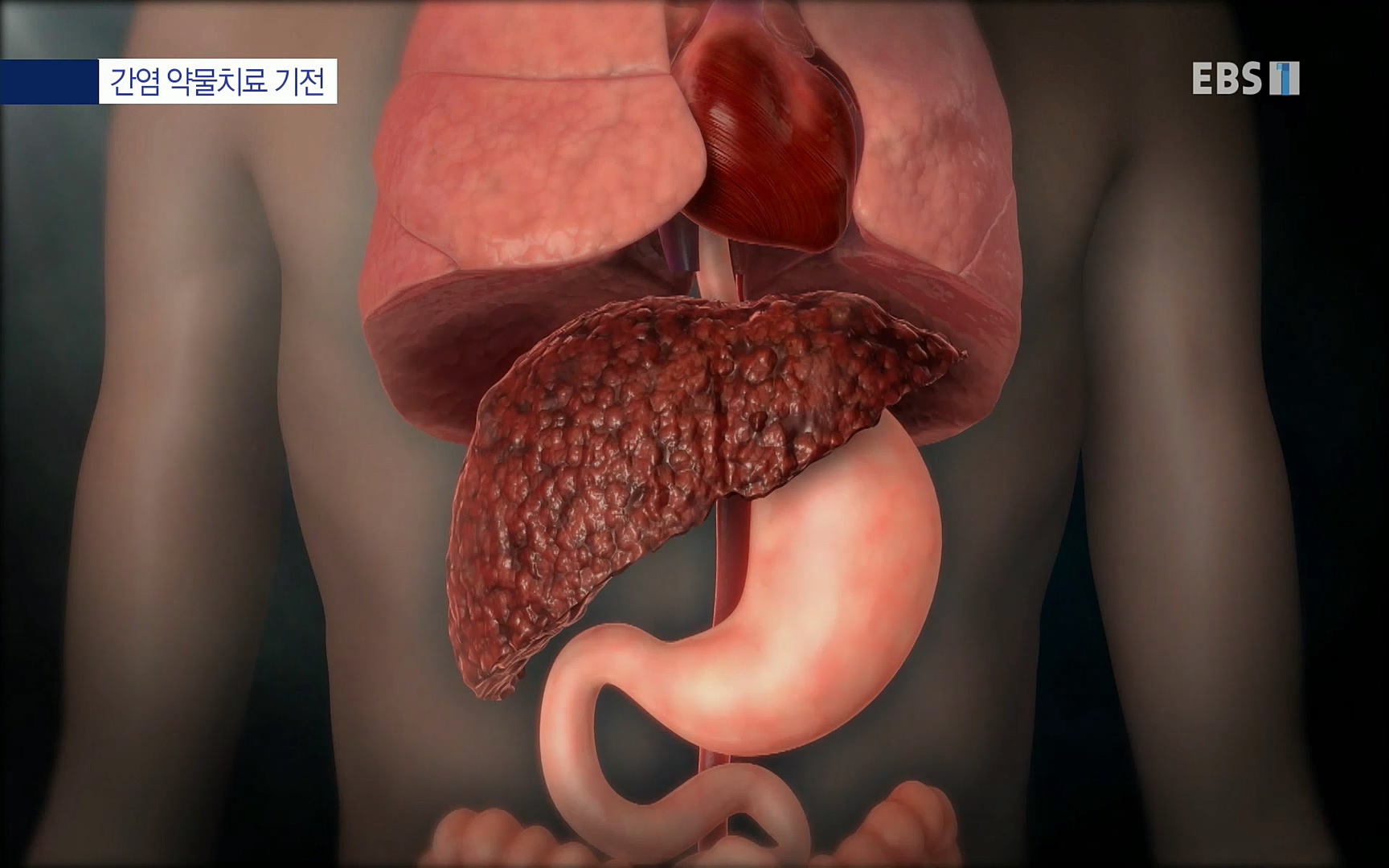 EBS 명의 헬스케어 - TV - 교육의 중심 EBS명의 15년 - 간, 완치에 도전하다.mp4_20220802_202427.996.jpg