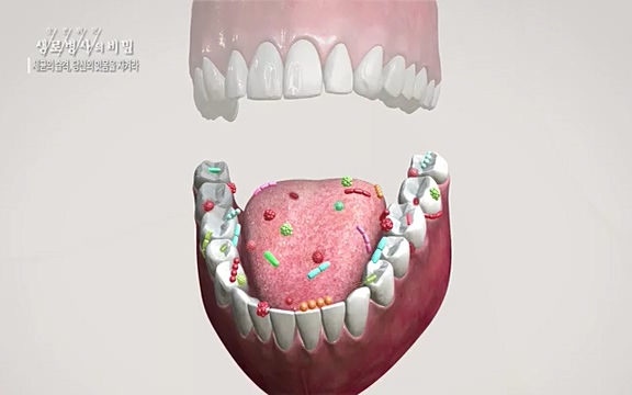[792회] 생로병사의 비밀 - KBS[세균의 습격, 당신의 잇몸을 지켜라!] 감기보다 병원을 더 자주 찾게 만드는 질병이 있다. 바로 치주질환이다. 2020년 외래 다빈도 질병 1위를 차지한 치은염 및 치주질환 환자는 1,637_20220505_141553.715.jpg