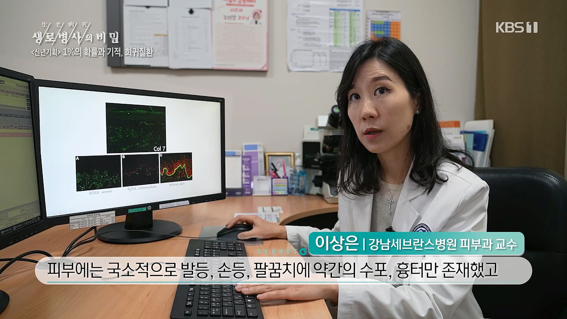생로병사의 비밀.E850.230104p.H264-F1RST.mp4_20230117_195202.322.jpg