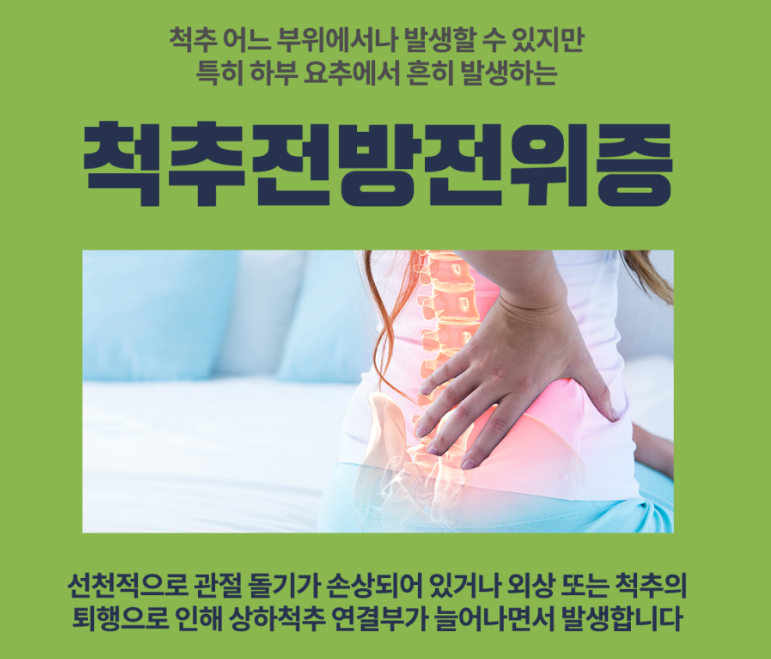 척추전방전위증 진단