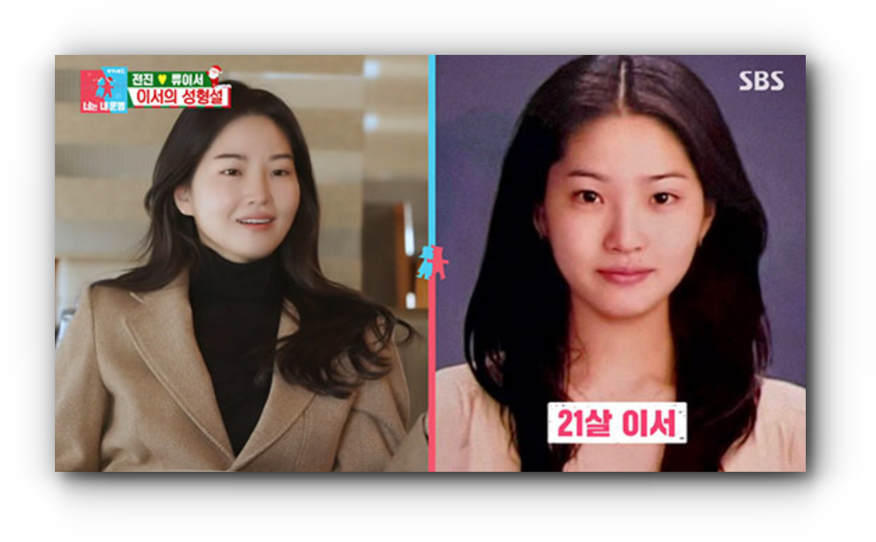  전진 류이서 성형설에 대해 입을 열다? 16년 전 사진 공개한 이유는?