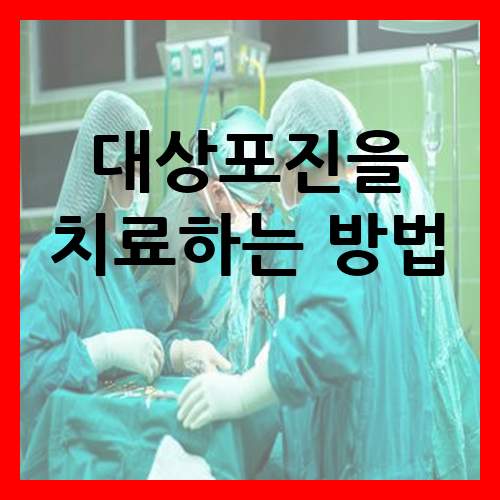  대상포진을 치료하는 방법