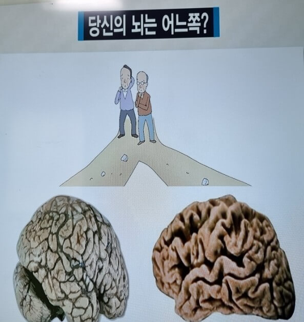 뇌의 노화