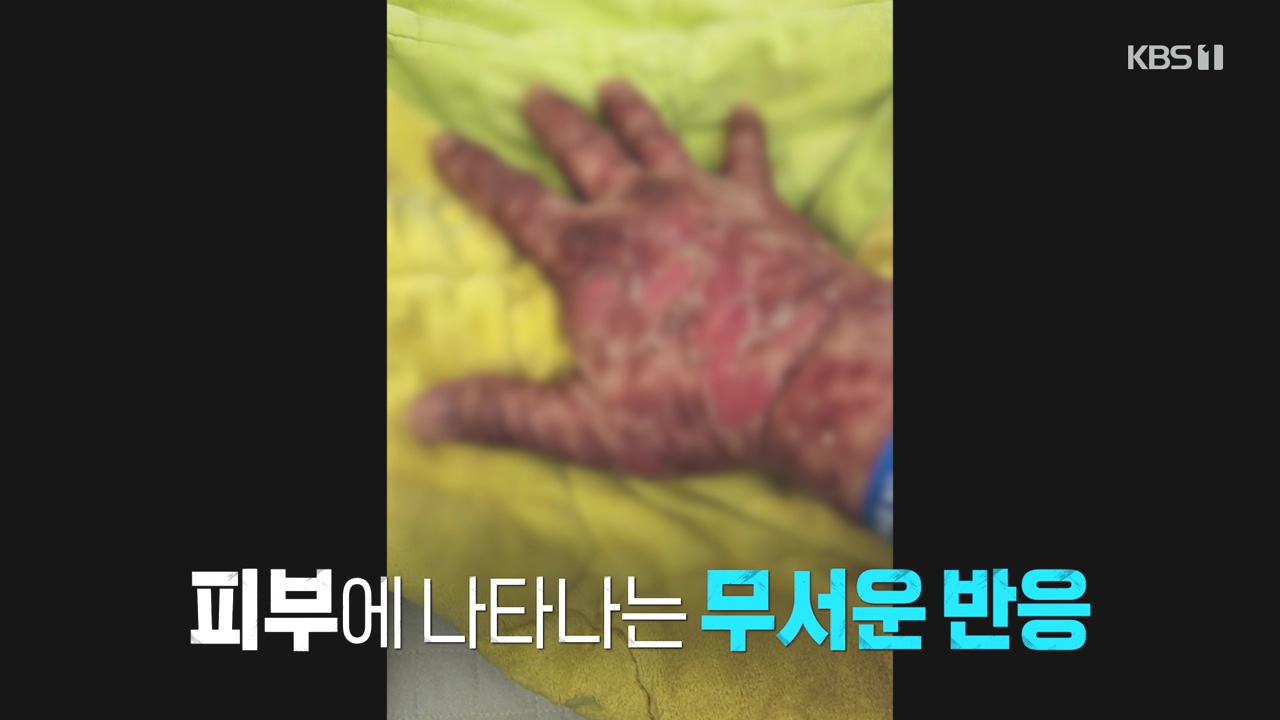 생로병사의 비밀.E910.240509p-NEXT.mp4_20240509_195922.812.jpg