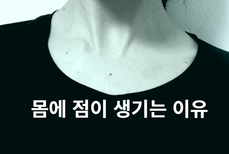  몸에 점이 많이 생기는 이유, 점 많으면 노화를 늦춘다?!