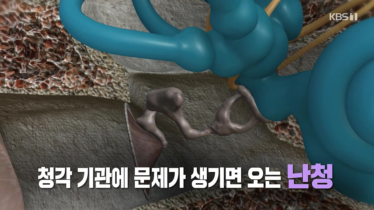 생로병사의 비밀.E883.230914p-NEXT.mp4_20230914_202354.062.jpg