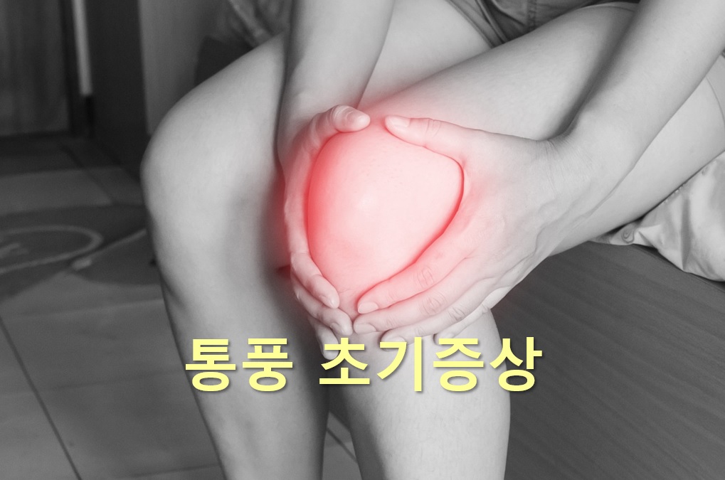  통풍 초기증상과 통풍 원인